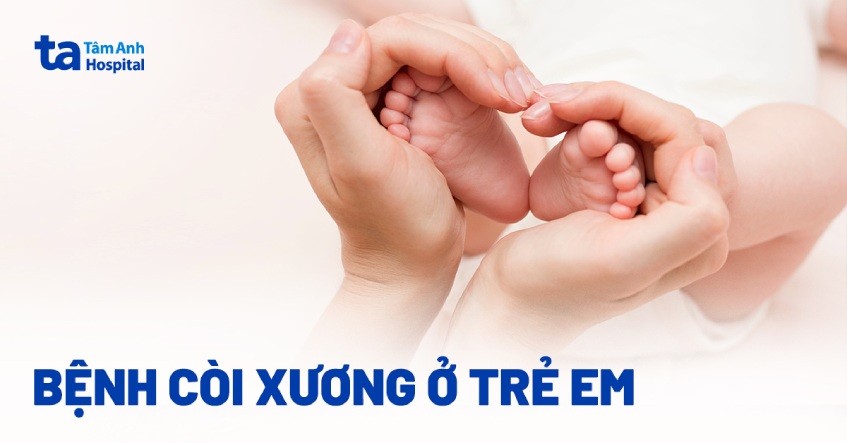 Còi xương ở trẻ